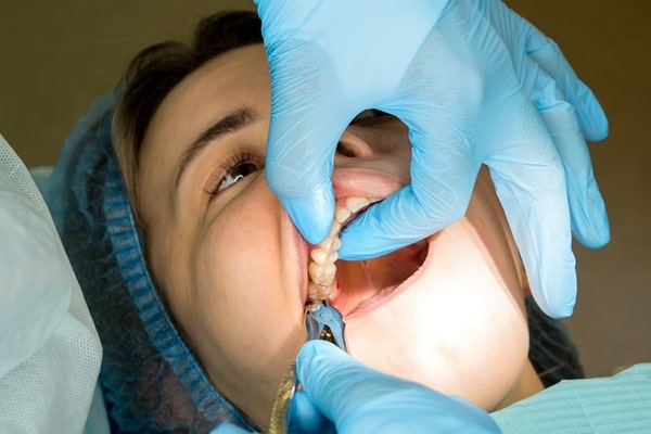 what-the-process-looks-like-regina-lakeview-dental-centre