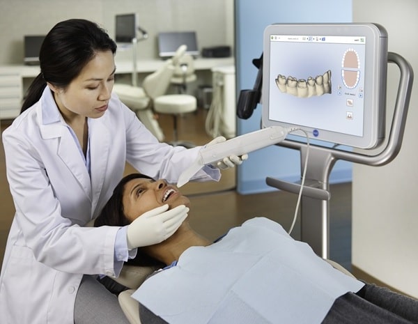 benefits-of-the-itero-scanner-regina-lakeview-dental-centre